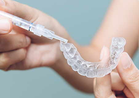 Person placing gel into a clear teeth whitening tray