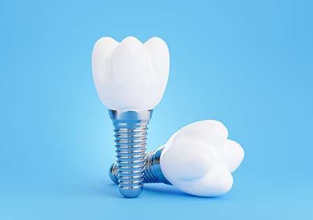 Illustration of two dental implants with crowns against a light blue background