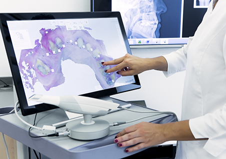 Dentist looking at a screen showing a digital impression of a row of teeth