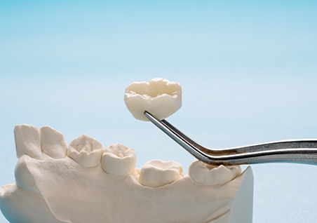 Pair of tweezers holding a dental crown