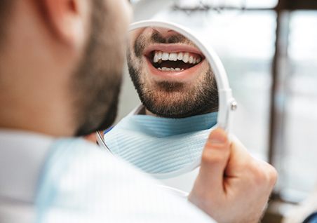 A man smiling in a mirror at his tooth-colored fillings