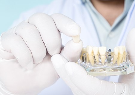 Dentist in white gloves holding sample implant and crown