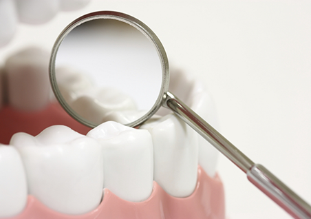 Illustration of a dental mirror next to a row of teeth