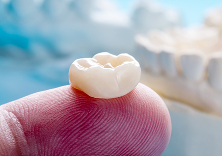 Dental crown resting on a finger