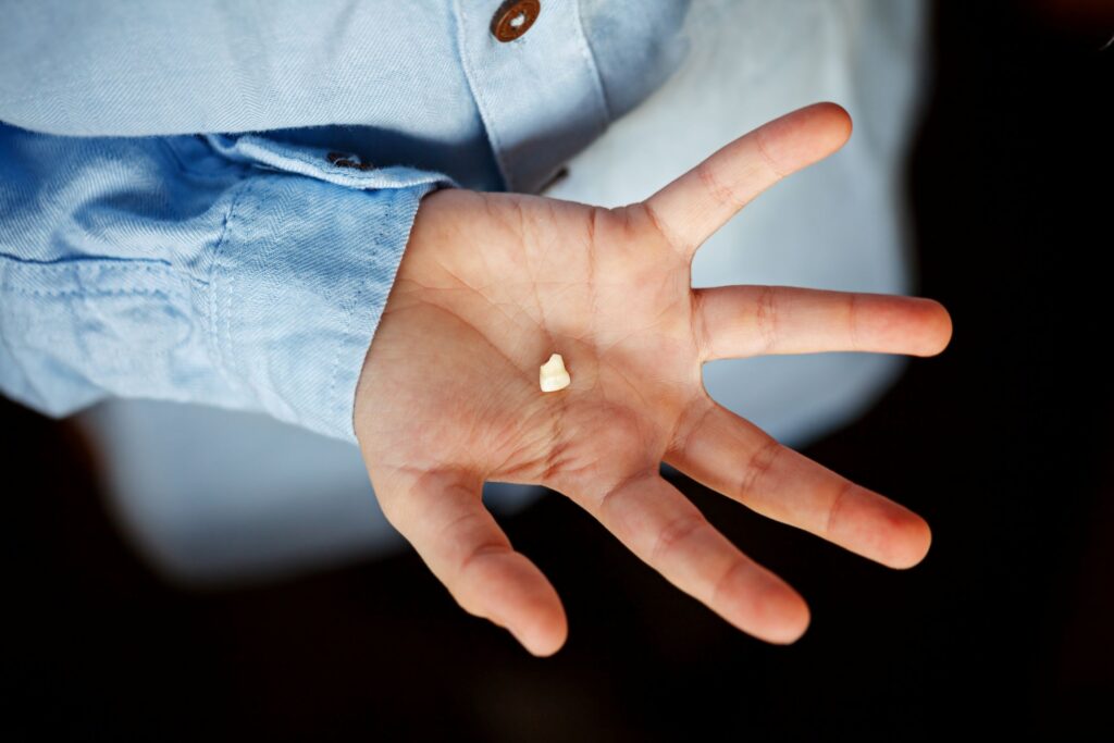 Bird's eye view of hand holding a broken tooth