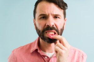 Man exposing inflamed gums. 